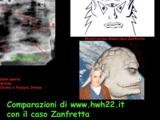Il caso Zanfretta 1 (documento storico)