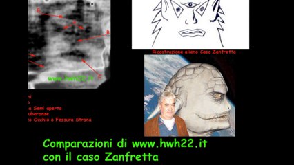 Il caso Zanfretta 2 (documento storico)