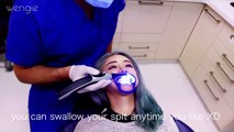 10 Minute Teeth Whitening ♥ Quickest Whitening at Dentist Cost & Review ♥ Philips Zoom