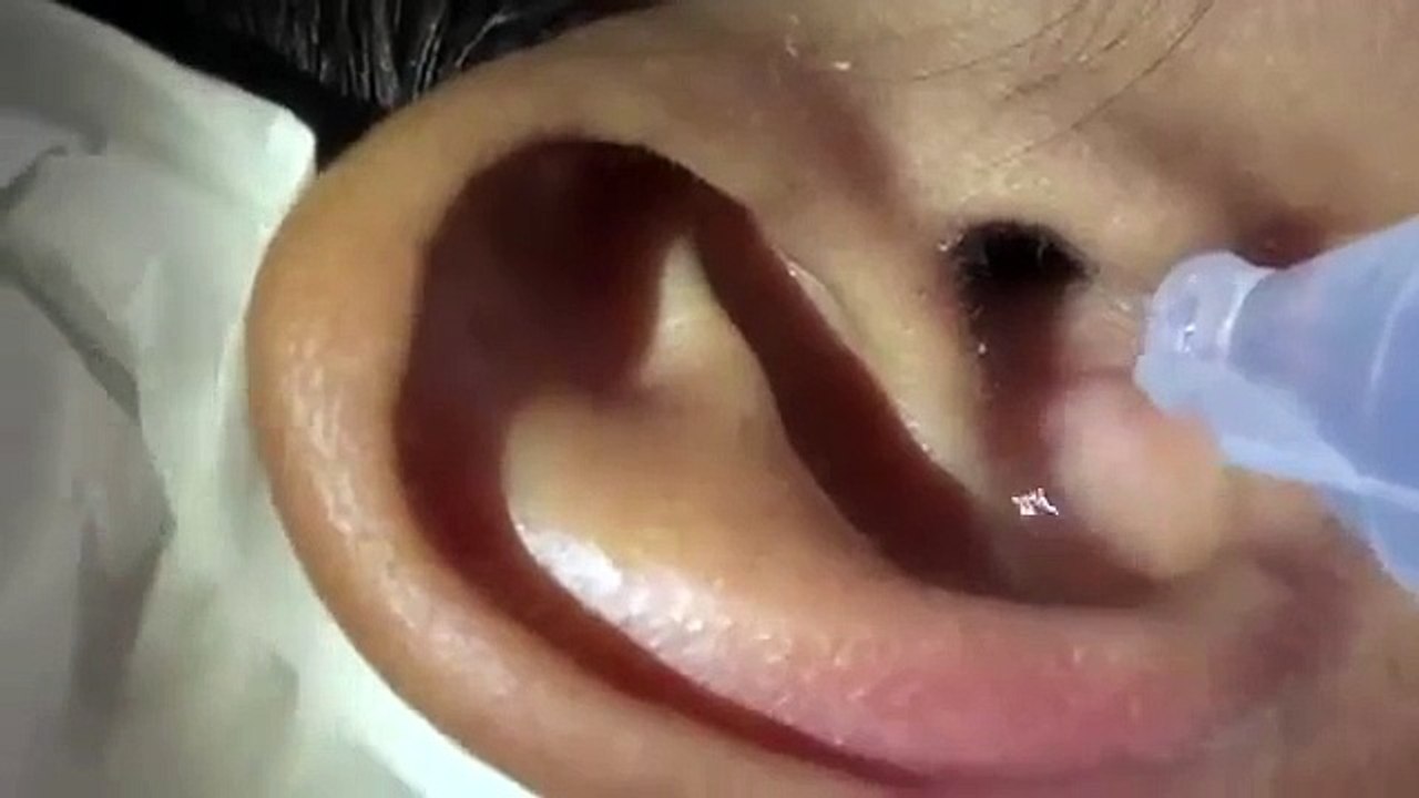 Spider-in-ear
