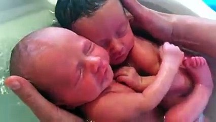 توأم يظن أنه لا يزال داخل رحم أمه ... سبحان الله