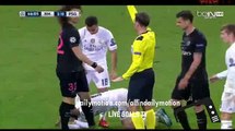 Isco Gets Injured - Real Madrid vs PSG - Champions League - 03.11.2015