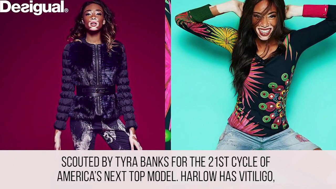 10 Unique Models Revolutionizing The Fashion World