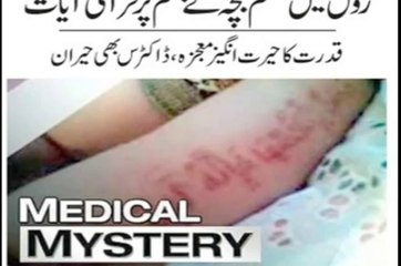 medical mystery Allah miracles