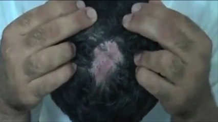 تواصل الانتهاكات والتعذيب داخل السجون التونسية