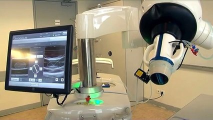 L’échothérapie : des ultrasons pour traiter des tumeurs bénignes