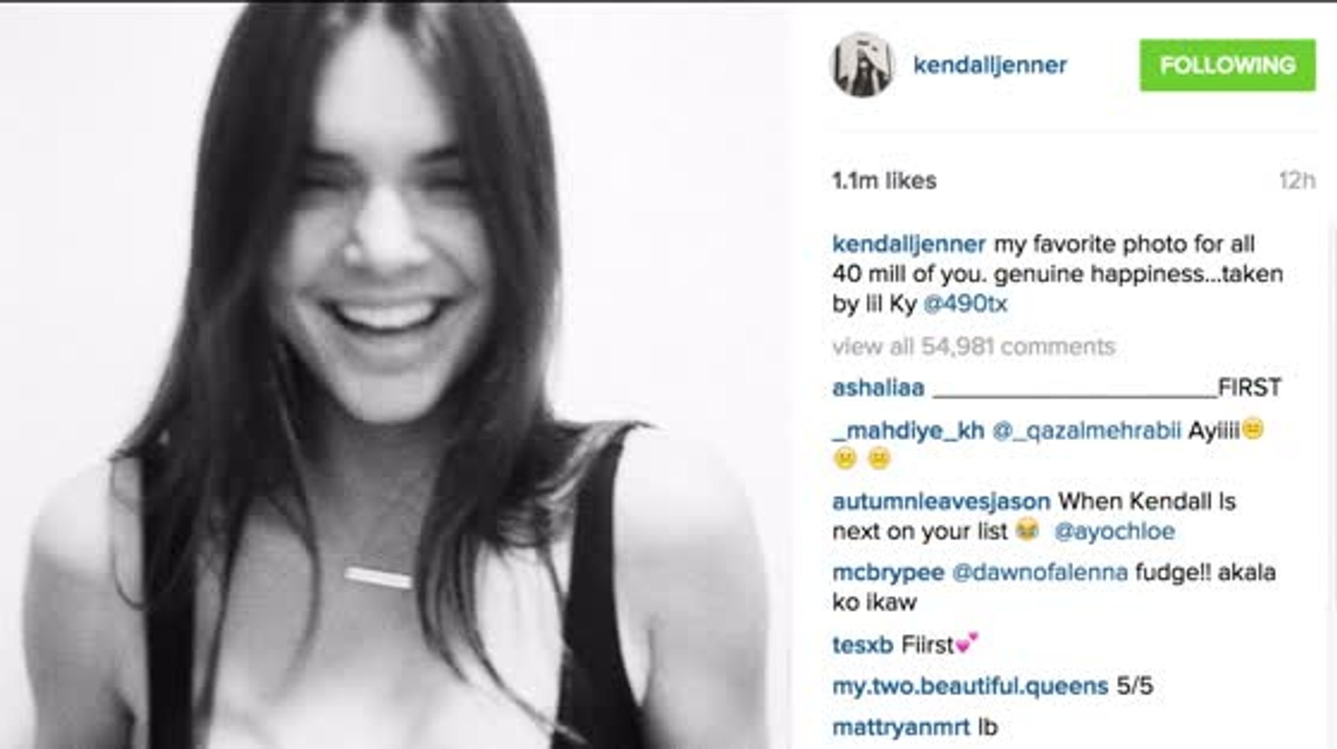 Kendall Jenner Posts Nipple Pic to Celebrate 40 Million Followers
