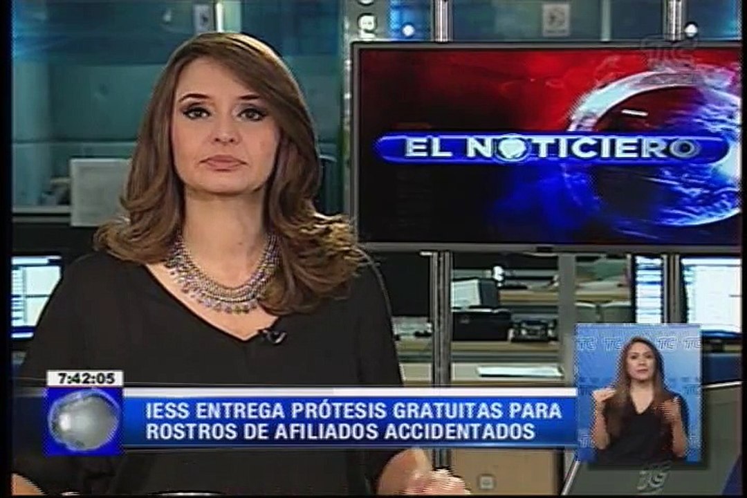 IESS entrega prótesis gratuitas para rostros de...