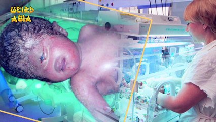 One Eye baby Born and Without nose (Must Watch)