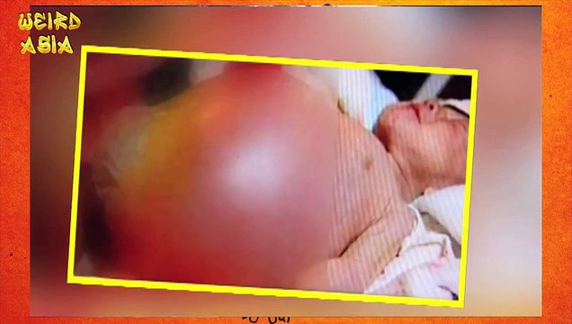 2 Year Old Gives Birth To Own Twin!