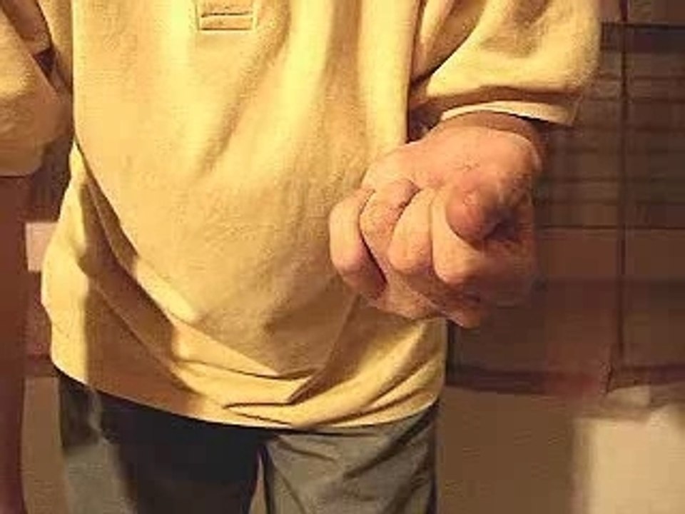 Disparition d'allumette