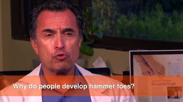 Why do I develop hammer toes?