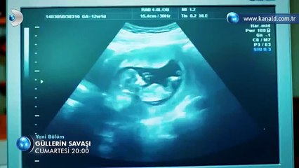 Güllerin Savaşı 56 Bölüm Fragmanı