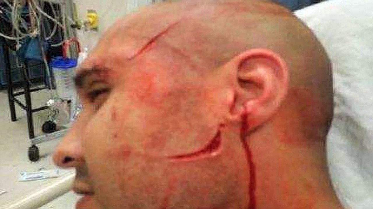 Corrections Officer Slashed in the Face at Rikers Island