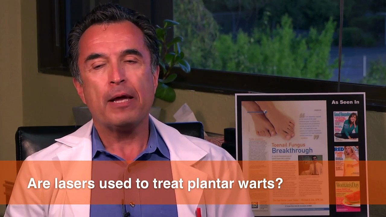 Are lasers used to treat Plantar Warts?