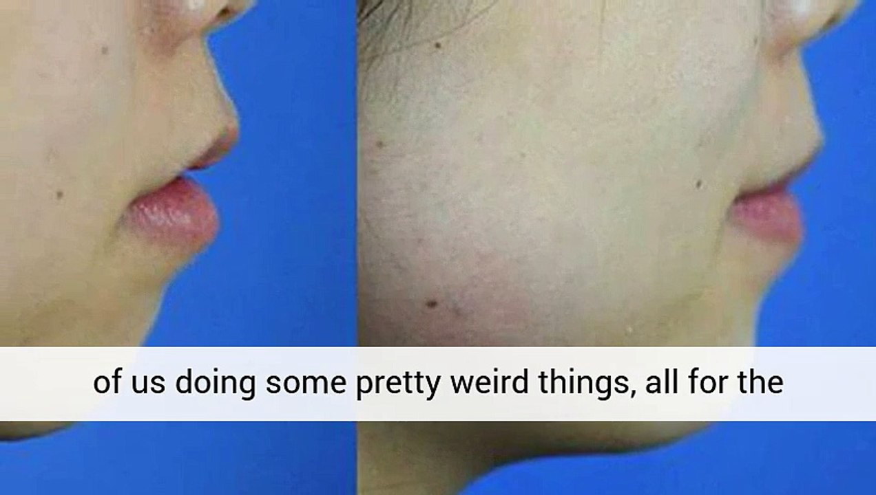 Top Rhinoplasty Lovejoy Georgia Call To RENT SPACE (413) 648 4336