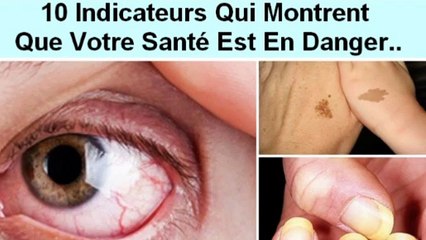 Si vous avez l'un de ces 10 Indicateurs, ça veut dire Que Votre Santé Est En Danger..