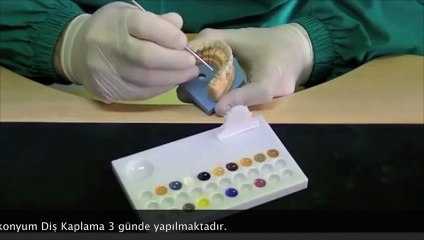 Zirkonyum Diş Kaplama Diş Kliniği Ankara www.mutludent.com/dis-klinigi-ankara.html
