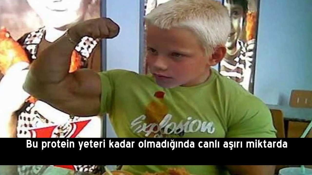 Genetik Bozukluk ile Dünyaya Gelmiş 10 Bebek