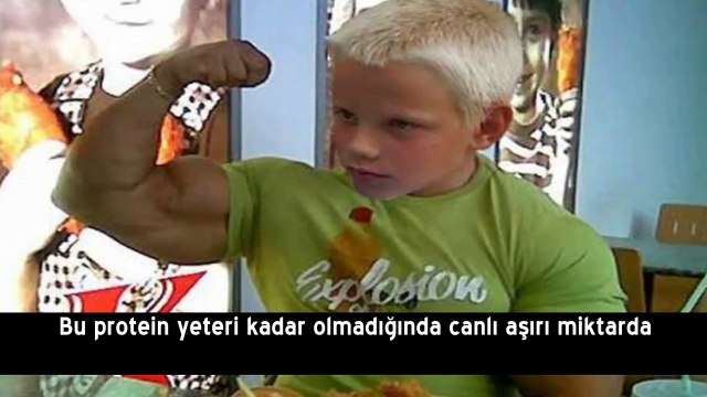 Genetik Bozukluk ile Dünyaya Gelmiş 10 Bebek