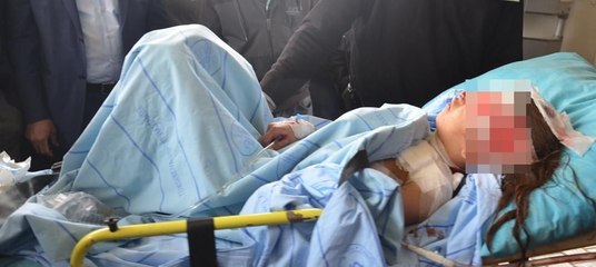 Buldukları cismin ellerinde patlaması sonucu 2 çocuk yaralandı