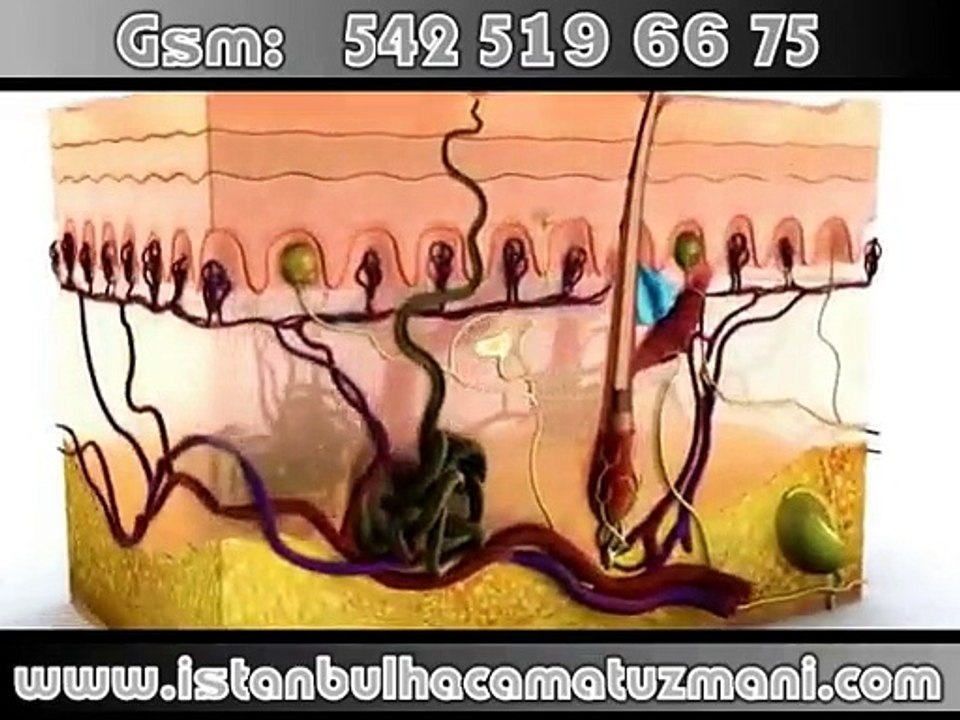 Hacamat Nedir - Komik videolar - Funny videos