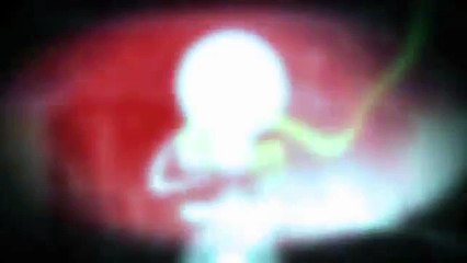 تصريح طبيب المنتخب الوطني ؛عبدالرزاق هيفتي ؛ حول الحالة الصحية لكل من الأحمدي ، عبادي و لزعر