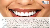 علاج تسوس الاسنان وجعله لا ينتشر بأسنانك أو ضروسك