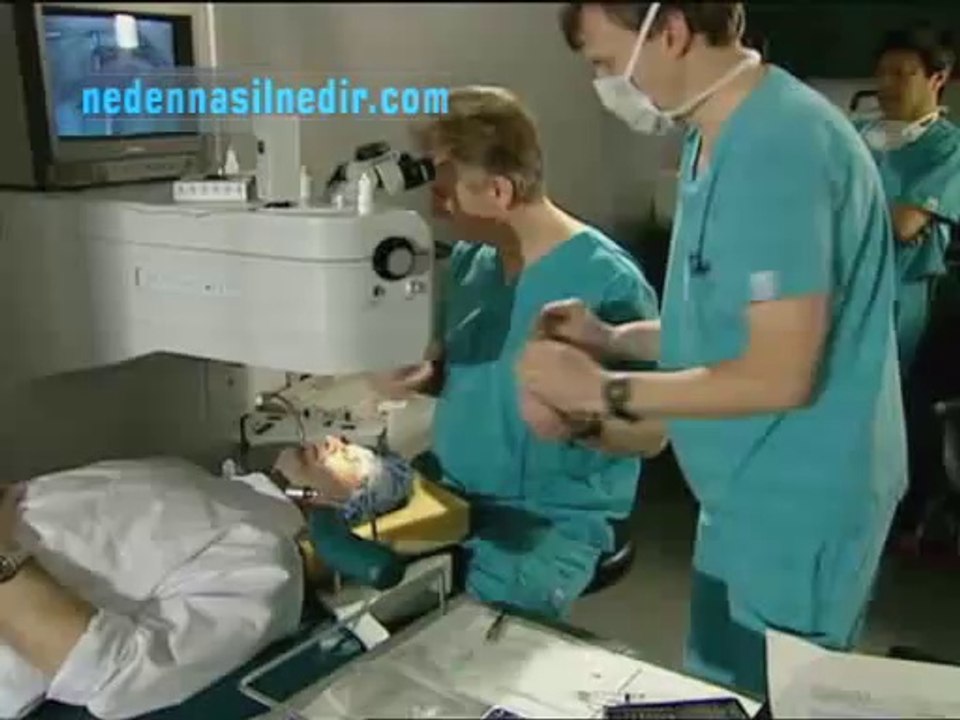 lazer ameliyatı