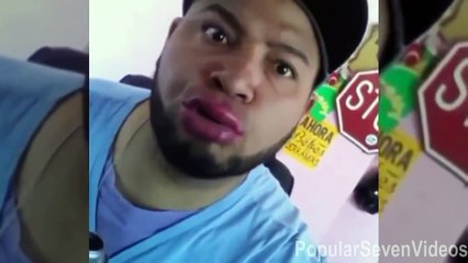 En iyi Dudak Büyütme Videoları [Derleme] Fails Compilation