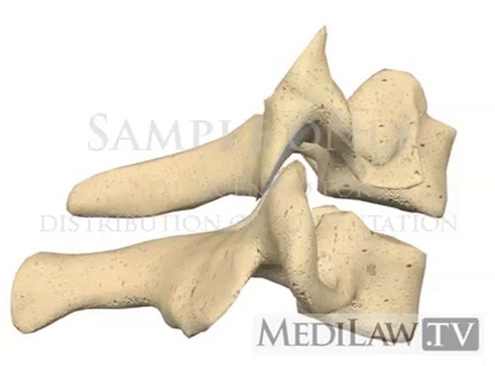 cervical facet