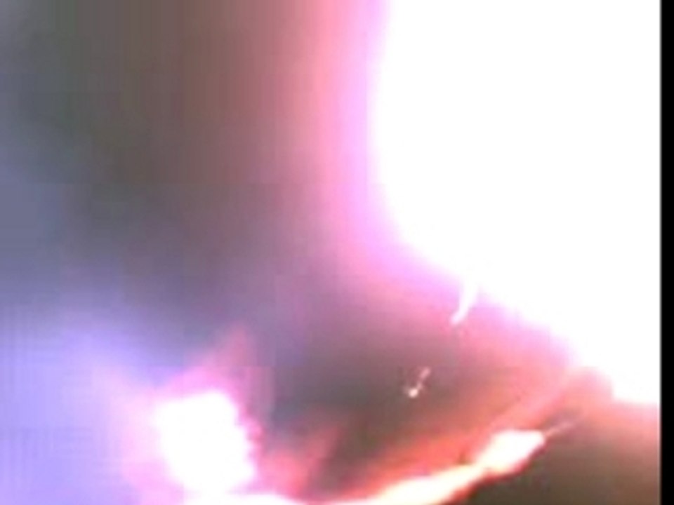 Crachage 2flamme