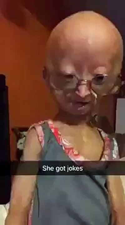 Adalia Rose fail laughs