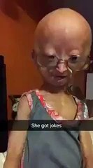 Adalia Rose fail laughs