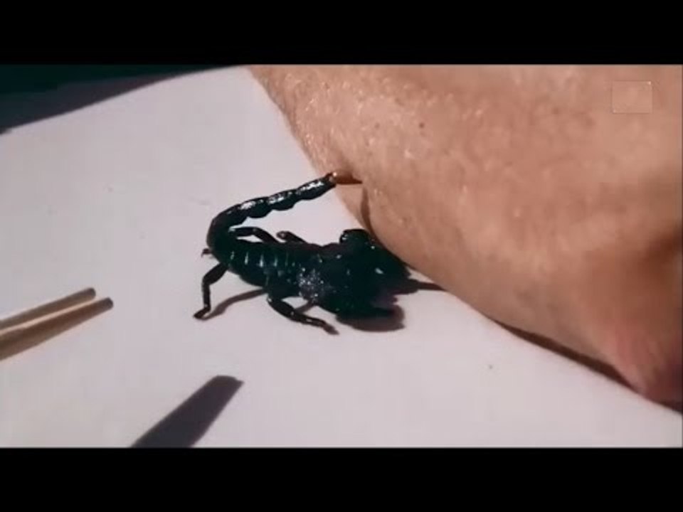 Yavaş Çekimde Akrep Sokması