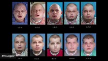 Surgeons In New York Perform 'Most Extensive' Face Transplant To Date