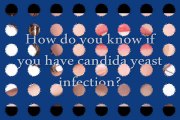 Various Symptoms That You Should Be Aware To Answer The Question How Do You Know If You Have Candida Yeast Infection