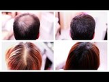 How to Cover Up Hair Loss, Bald Spots, Thinning Hair, Receding Hairline Effectively- A MUST SEE