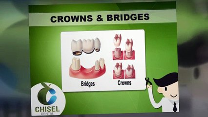 Chisel Dental Clinic