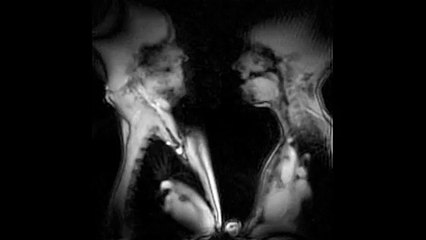 Effect of Kissing on human body