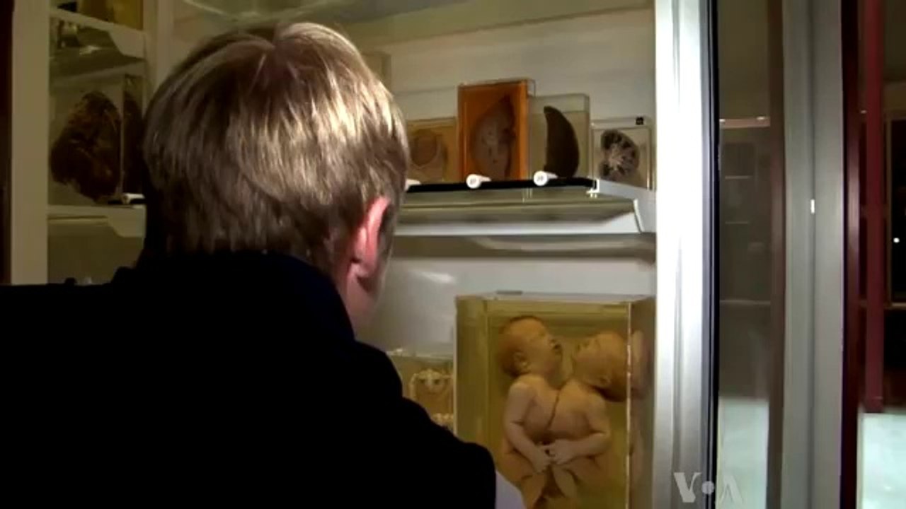 Medical Museum - Anatomical collections of bones