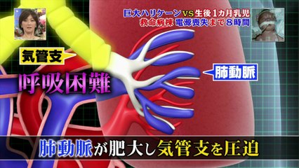 トリハダ　巨大ハリケーン vs 生後1カ月乳児・救命病棟電源喪失まで8時間