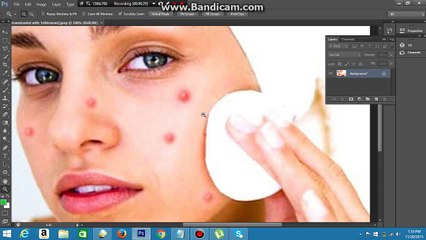 How to remove pimples using Adobe Photoshop
