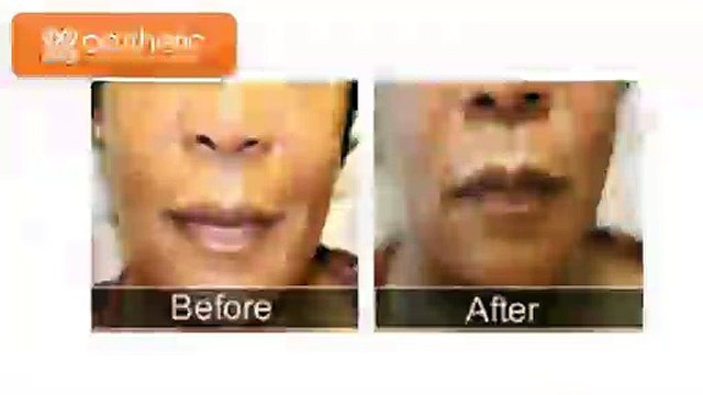 Aesthetic Laser and Vein Center - Cosmetic surgery Before and After looks