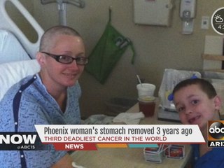 Phoenix woman’s stomach removed