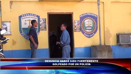 Un hombre denuncia a policías que lo golpearon salvajemente en Choloma