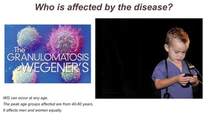 Wegeners granulomatosis and microscopic polyangiitis