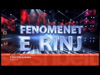 X FACTOR ALBANIA 2 AUDICIONET SPOTI
