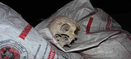 Çöp konteynerinde insana ait kafatası bulundu