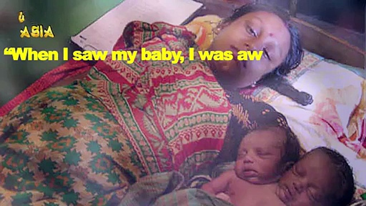 Baby Girl With TWO HEADS - SHOCKING -